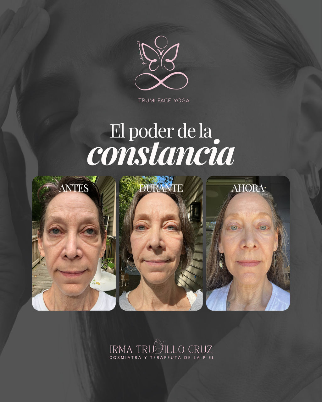 TRUMI Face Yoga By Irma Trujillo