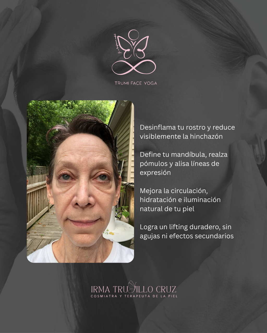 TRUMI Face Yoga By Irma Trujillo