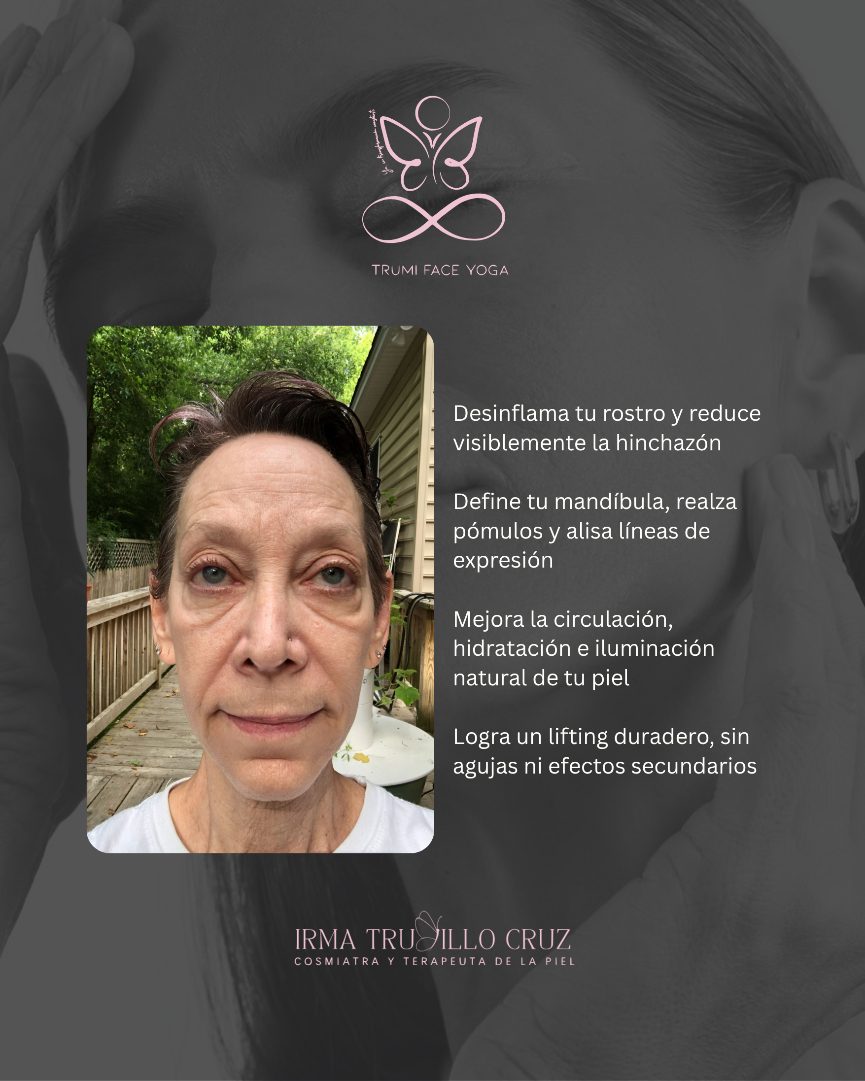 TRUMI Face Yoga By Irma Trujillo