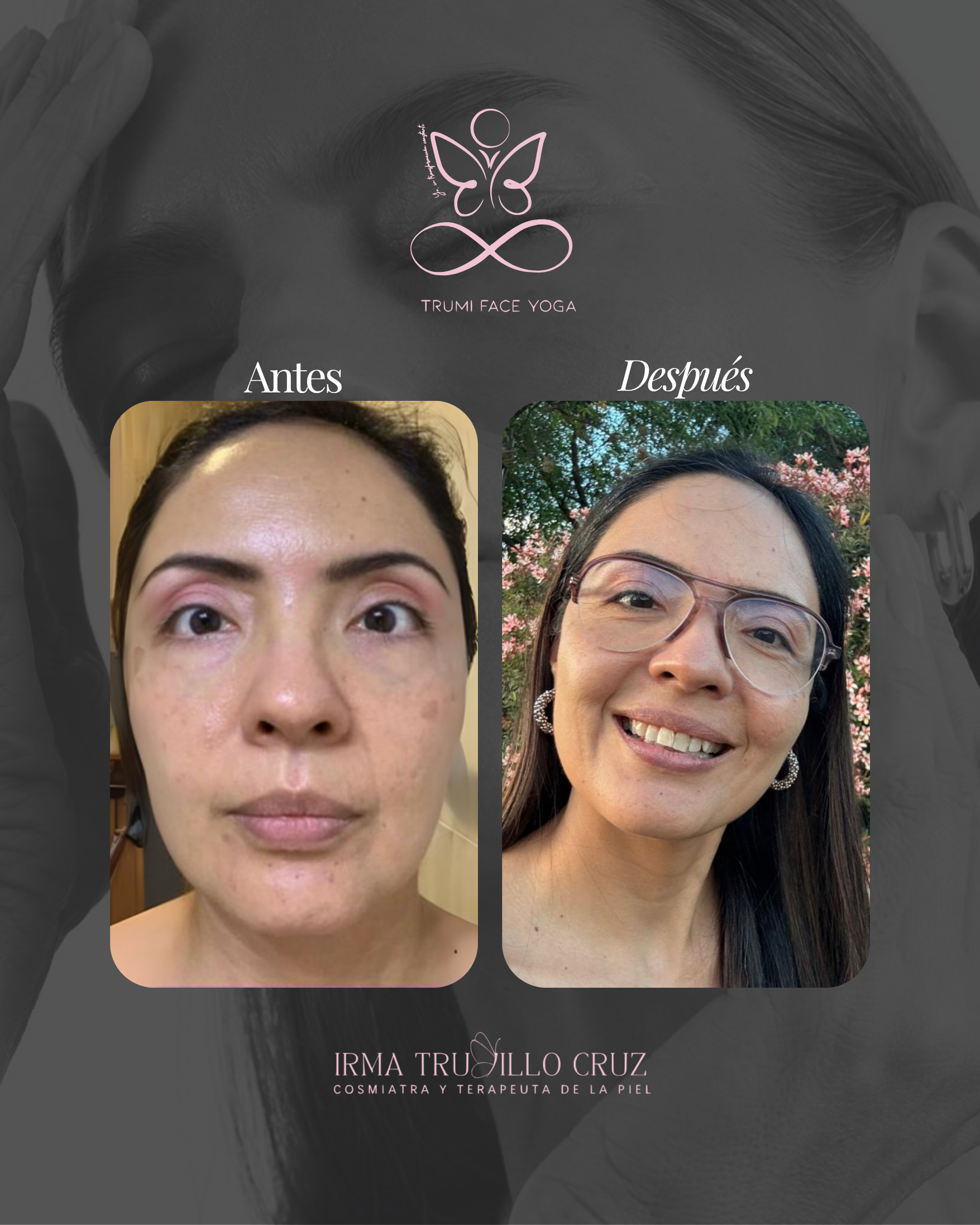 TRUMI Face Yoga By Irma Trujillo